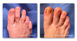 before-and-after-image-14-july-2022