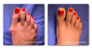 before and after image patient 43