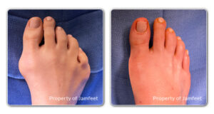 before and after image patient 41