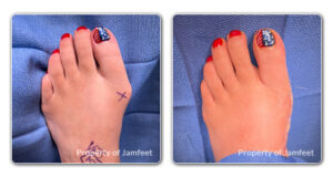 before and after image patient 40